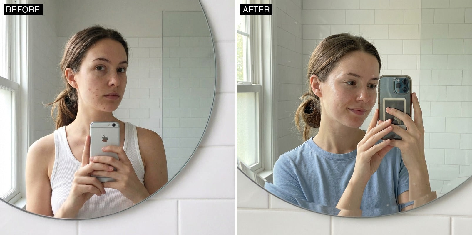 Before and after — real customer skin transformation with GLOW serum